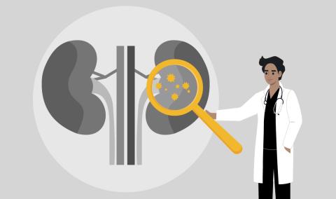 A cartoon graphic of a physician pointing at some kidneys.